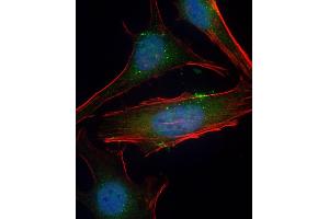 Immunofluorescence (IF) image for anti-serum/glucocorticoid Regulated Kinase 1 (SGK1) (AA 70-103), (Ser78) antibody (ABIN6243740)