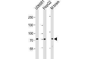 Western blot analysis of lysates from U266B1,HepG2 cell line,mouse brain tissue lysate(from left to right), using NT5E- Antibody (ABIN388750 and ABIN2839011). (CD73 Antikörper  (C-Term))