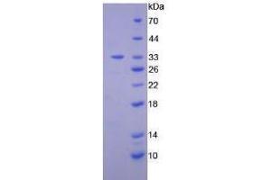 Image no. 1 for Diacylglycerol Kinase, epsilon 64kDa (DGKE) (AA 243-502) (Active) protein (His tag) (ABIN6239838) (DGKE Protein (AA 243-502) (His tag))