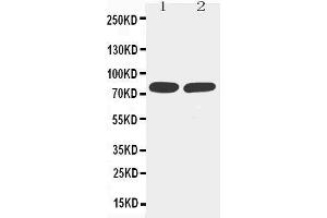 Anti-TNF Receptor II antibody, Western blotting Lane 1: MM453 Cell Lysate Lane 2: JURKAT Cell Lysate (TNFRSF1B Antikörper  (Middle Region))