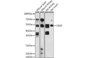 Western blot analysis of extracts of various cell lines, using CD47 antibody (ABIN6127604, ABIN6138199, ABIN6138201 and ABIN6223104) at 1:1000 dilution. (CD47 Antikörper  (AA 20-140))