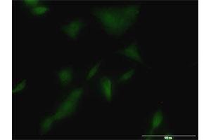 Immunofluorescence of monoclonal antibody to KLK3 on A-549 cell. (Prostate Specific Antigen Antikörper  (AA 1-261))