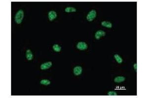 Immunostaining analysis in HeLa cells. (DDX39 Antikörper)