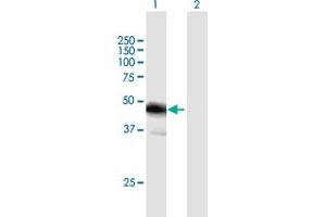 Western Blot analysis of FBLIM1 expression in transfected 293T cell line by FBLIM1 MaxPab polyclonal antibody. (FBLIM1 Antikörper  (AA 1-373))
