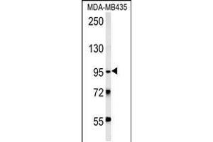 Western blot analysis in MDA-MB435 cell line lysates (15ug/lane). (TRHDE Antikörper  (C-Term))