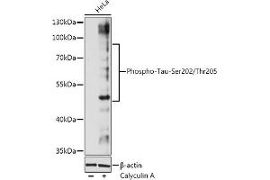 Western blot analysis of extracts of Hela cells, using Phospho-Tau-Ser202/Thr205 antibody (ABIN7268525) at 1:1000 dilution. (MAPT Antikörper  (pSer202, pThr205))