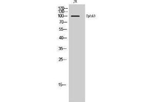 Western Blotting (WB) image for anti-EPH Receptor A3 (EPHA3) (Ser346) antibody (ABIN3184502) (EPH Receptor A3 Antikörper  (Ser346))