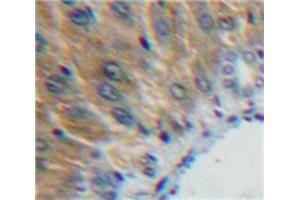 Used in DAB staining on fromalin fixed paraffin-embedded Liver tissue (SHBG Antikörper  (AA 224-388))