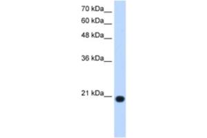 Western Blotting (WB) image for anti-Ubiquitously-Expressed, Prefoldin-Like Chaperone (UXT) antibody (ABIN2463113) (UXT Antikörper)