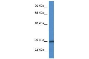 Western Blot showing HPGD antibody used at a concentration of 1 ug/ml against MDA-MB-435S Cell Lysate