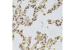 Immunohistochemistry of paraffin-embedded rat lung using FGF2 antibody (ABIN1872685) at dilution of 1:100 (40x lens). (FGF2 Antikörper)