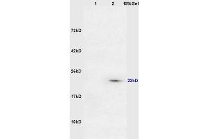 Lane 1: mouse lung lysates Lane 2: mouse intestine lysates probed with Anti DARPP32 Polyclonal Antibody, Unconjugated (ABIN680323) at 1:200 in 4 °C. (DARPP32 Antikörper  (AA 51-150))