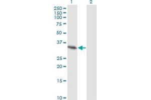 Western Blotting (WB) image for anti-Sprouty Homolog 2 (SPRY2) (AA 1-315) antibody (ABIN564439)