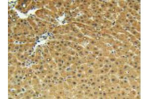 IHC-P analysis of Human Liver Tissue, with DAB staining. (MMP13 Antikörper  (AA 103-290))