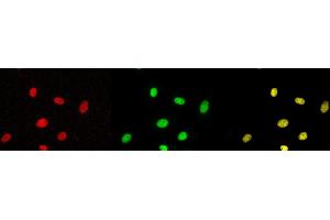 Immunofluorescence (IF) image for anti-Tumor Protein P53 (TP53) (pSer315) antibody (ABIN3201006) (p53 Antikörper  (pSer315))