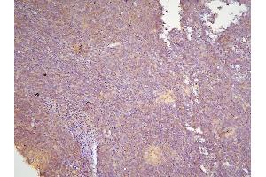 IHC analysis of HOOK3 using anti-HOOK3 antibody (ABIN6719547). (HOOK3 Antikörper  (AA 14-198))