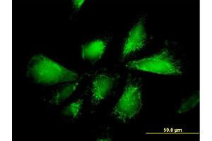 Immunofluorescence (IF) image for anti-Solute Carrier Family 25, Member 13 (Citrin) (slc25a13) (AA 2-80) antibody (ABIN523541)