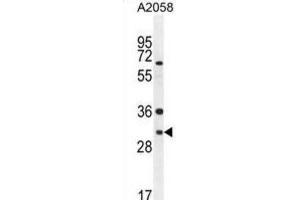 Western Blotting (WB) image for anti-ARV1 Homolog (ARV1) antibody (ABIN2995757) (ARV1 Antikörper)