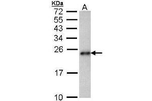 WB Image Sample (30 ug of whole cell lysate) A: Hep G2 , 15% SDS PAGE antibody diluted at 1:1000 (CARHSP1 Antikörper)