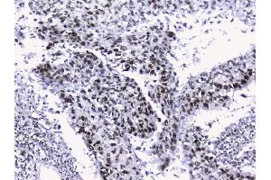 IHC analysis of nmt55/p54nrb using anti-nmt55/p54nrb antibody (ABIN3044530). (NONO Antikörper  (N-Term))