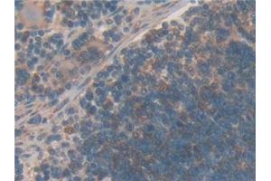 Immunohistochemistry (IHC) image for anti-Gelsolin (GSN) (AA 432-625) antibody (ABIN7429301)