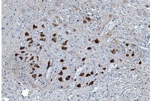 IHC analysis of MAP3K8 using anti-MAP3K8 antibody (ABIN4886663). (MAP3K8 Antikörper  (AA 9-193))
