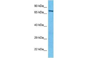Host:  Rabbit  Target Name:  PAK6  Sample Type:  HepG2 Whole Cell lysates  Antibody Dilution:  1. (PAK6 Antikörper  (C-Term))