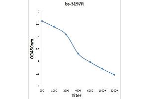 Antigen: 0. (IRS1 Antikörper  (pSer1101))