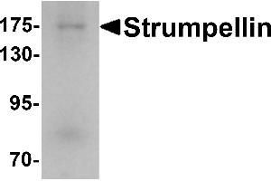 Western blot analysis of Strumpellin in human ovary tissue lysate with Strumpellin antibody at 1 µg/mL. (Strumpellin Antikörper  (C-Term))