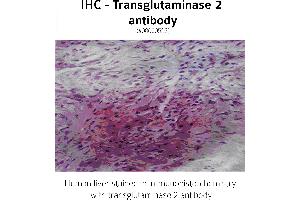 Image no. 2 for anti-Transglutaminase 2 (C Polypeptide, Protein-Glutamine-gamma-Glutamyltransferase) (TGM2) antibody (ABIN346957) (Transglutaminase 2 Antikörper)