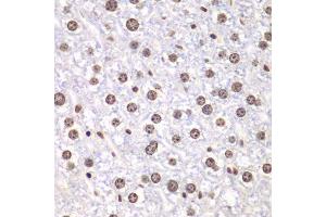 Immunohistochemistry of paraffin-embedded mouse liver using TOP1 antibody. (Topoisomerase I Antikörper  (AA 1-100))