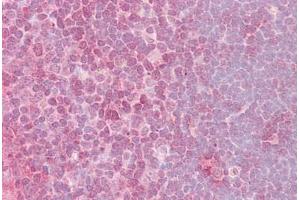 Anti-CRKL antibody IHC staining of human thymus. (CrkL Antikörper  (AA 292-303))