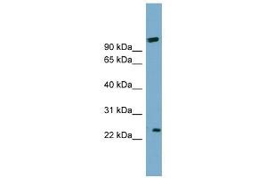 ARL8B antibody used at 1 ug/ml to detect target protein.