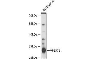 Western blot analysis of extracts of Rat thymus, using VPS37B antibody (ABIN7271278) at 1:1000 dilution. (VPS37B Antikörper  (AA 60-170))