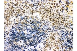 Anti- CTBP1 Picoband antibody, IHC(P) IHC(P): Rat Spleen Tissue (CTBP1 Antikörper  (C-Term))