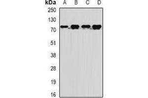 Western blot analysis of MTMR14 expression in BT474 (A), Jurkat (B), mouse liver (C), rat brain (D) whole cell lysates. (MTMR14 Antikörper)