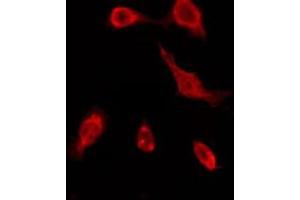 ABIN6276162 staining COLO205 by IF/ICC. (OR51A7 Antikörper  (C-Term))