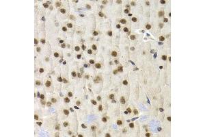 Immunohistochemistry of paraffin-embedded mouse brain using UMPS antibody (ABIN5973202) at dilution of 1/200 (40x lens).