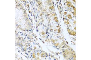 Immunohistochemistry of paraffin-embedded human stomach using RNASE13 antibody at dilution of 1:100 (40x lens). (RNASE13 Antikörper)