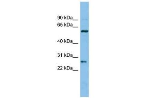 Chymotrypsinogen B1 antibody used at 1 ug/ml to detect target protein. (CTRB1 Antikörper  (Middle Region))