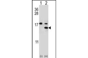 Western blot analysis of S100A11 (arrow) using rabbit polyclonal S100A11 Antibody (S6) (ABIN389308 and ABIN2839429). (S100A11 Antikörper  (AA 1-30))