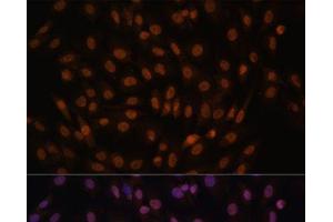 Immunofluorescence analysis of C6 cells using FCF1 Polyclonal Antibody at dilution of 1:100. (FCF1 Antikörper)