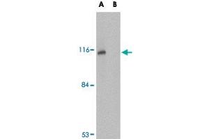 Western blot analysis of JPH3 in Daudi cell lysate with JPH3 polyclonal antibody  at 1 ug/mL in (A) the absence and (B) the presence of blocking peptide. (Junctophilin 3 Antikörper  (Internal Region))