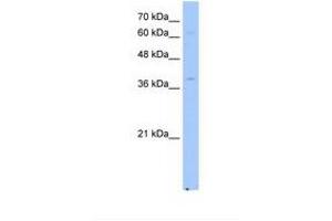 Image no. 1 for anti-NAD(P) Dependent Steroid Dehydrogenase-Like (NSDHL) (AA 181-230) antibody (ABIN321218) (NSDHL Antikörper  (AA 181-230))