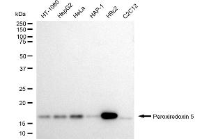 Western blotting analysis using Peroxiredoxin 5 antibody (ABIN7799780). (Rekombinanter Peroxiredoxin 5 Antikörper)