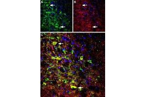 Expression of NTSR1 in rat brainImmunohistochemical staining of perfusion-fixed frozen rat brain sections using Anti-Neurotensin Receptor 1 (extracellular) Antibody (ABIN7043383, ABIN7044767 and ABIN7044768), (1:100). (Neurotensin Receptor 1 (High Affinity) (NTSR1) Peptid)