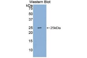 Detection of Recombinant PK, Human using Polyclonal Antibody to Pyruvate kinase isozymes R/L (PKLR) (PKLR Antikörper  (AA 219-420))