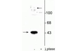 Western blot of human T47D cells showing specific immunolabeling of the ~45 kDa MEK 1 protein phosphorylated at Thr386 in the first lane (-). (MEK1 Antikörper  (pThr386))