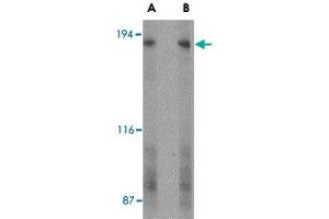 Western blot analysis of GPR124 in human bladder tissue lysate with GPR124 polyclonal antibody  at (A) 2 and (B) 4 ug/mL . (GPR124 Antikörper  (C-Term))