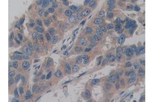 Immunohistochemistry (IHC) image for anti-Amelogenin, X-Linked (AMELX) (AA 49-187) antibody (ABIN1857975)